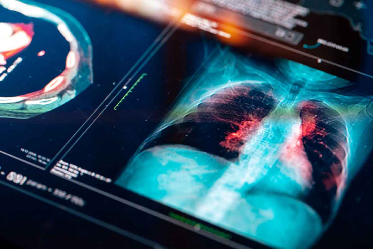 Translational Respiratory Research